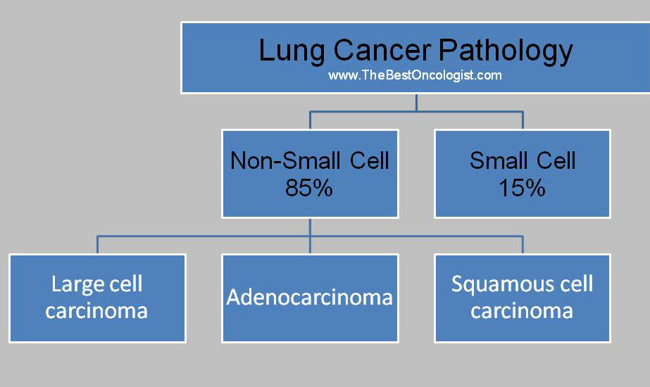 انواع سرطان الرئة