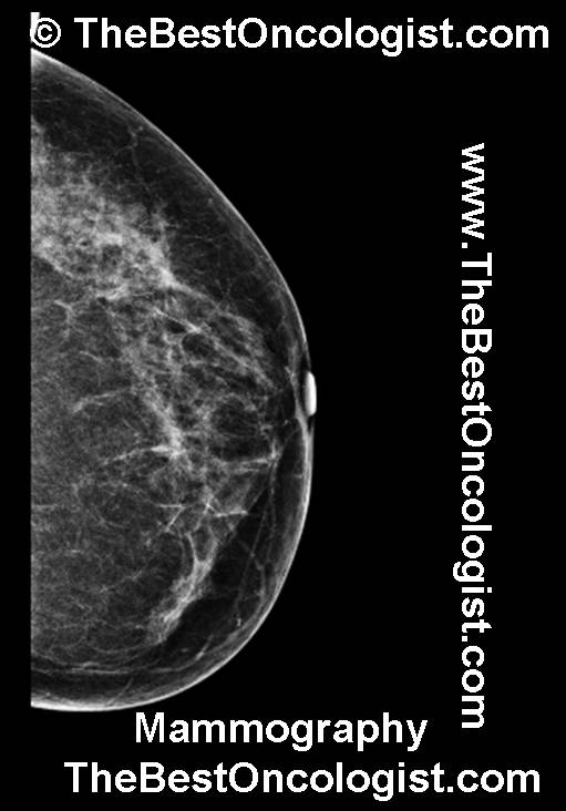 Normal Mamography ماموغرافيا